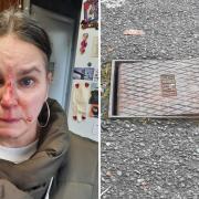 Woman left with black eyes and bloodied nose after tripping over raised drain