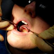Data from the Office for Health Improvement and Disparities has revealed that children in Wiltshire have tooth extractions in hospital at a 70% higher rate than the national average.